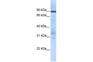 WB Suggested Anti-EWSR1 Antibody Titration:  0. (EWSR1 抗体  (Middle Region))