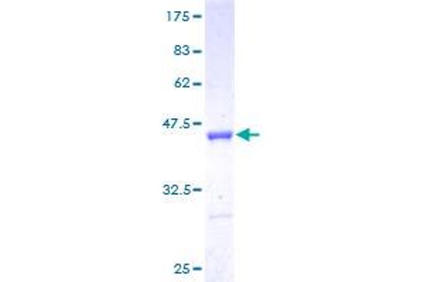 LSM5 Protein (AA 1-91) (GST tag)