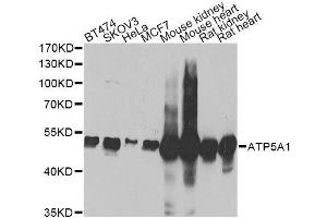 Western blot analysis of extracts of various cell lines, using ATP5A1 Antibody. (ATP5A1 抗体)