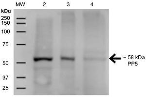 Western Blot analysis of Human A431, HEK293, and Jurkat cell lysates showing detection of ~58 kDa PP5 protein using Mouse Anti-PP5 Monoclonal Antibody, Clone 12F7 . (PP5 抗体  (Atto 488))