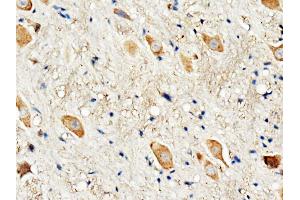 Anti-Dopamine Receptor D3 antibody, IHC(P) IHC(P): Rat Brain Tissue (DRD3 抗体  (C-Term))