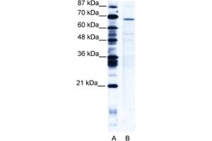 Western Blotting (WB) image for anti-PC4 and SFRS1 Interacting Protein 1 (PSIP1) antibody (ABIN2461014) (PSIP1 抗体)