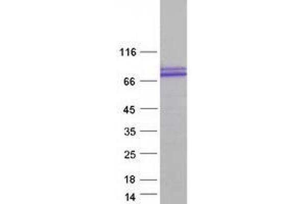 TRIM32 Protein (Transcript Variant 2) (Myc-DYKDDDDK Tag)