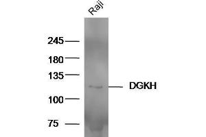 Raji cell lysates probed with Anti-DGKH Polyclonal Antibody  at 1:5000 90min in 37˚C. (DGKH 抗体  (AA 51-150))