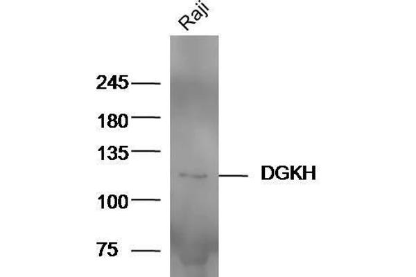 DGKH 抗体  (AA 51-150)