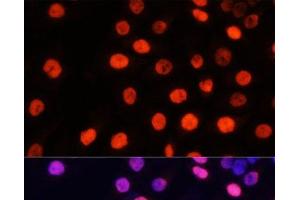 Immunofluorescence analysis of HeLa cells using MonoMethyl-NONO-R357/R365 Polyclonal Antibody at dilution of 1:100 (40x lens). (NONO 抗体  (meArg357, meArg365))