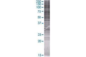 Western Blotting (WB) image for SLC33A1 293T Cell Transient Overexpression Lysate(Denatured) (ABIN1334434)