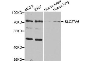 Western blot analysis of extracts of various cell lines, using SLC27A6 antibody (ABIN5974523) at 1/1000 dilution. (SLC27A6 抗体)