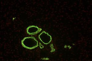 Immunohistochemistry (Paraffin-embedded Sections) (IHC (p)) image for anti-Keratin 19 (KRT19) antibody (ABIN94290)