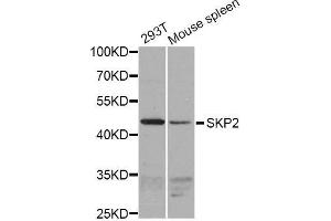 Western blot analysis of extracts of various cell lines, using SKP2 antibody (ABIN5995995) at 1/1000 dilution. (SKP2 抗体)