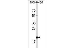 Western blot analysis in NCI-H460 cell line lysates (35ug/lane). (TMED2 抗体  (N-Term))