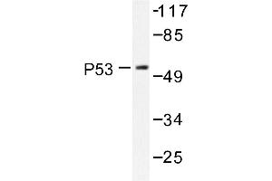 Image no. 1 for anti-Tumor Protein P53 (TP53) antibody (ABIN272050) (p53 抗体)