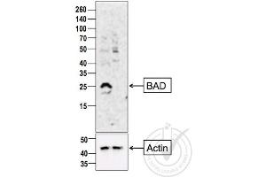 Western Blotting (WB) image for anti-BCL2-Associated Agonist of Cell Death (BAD) (AA 101-204) antibody (ABIN674709)