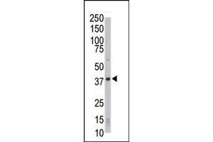 Western blot analysis of anti-CDK4 Pab in HL-60 cell lysate. (CDK4 抗体  (C-Term))