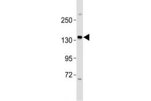 Western blot testing of ERBB4 antibody at 1:2000 dilution + MCF-7 lysate; Predicted molecular weight: 147-180 kDa (precursor), 120, 80 kDa (cleaved forms). (ERBB4 抗体  (AA 1141-1166))