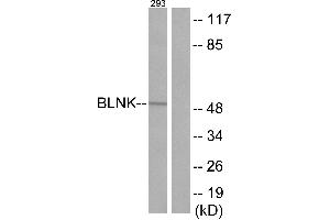 Immunohistochemistry analysis of paraffin-embedded human tonsil tissue using BLNK (Ab-96) antibody. (B-Cell Linker 抗体)