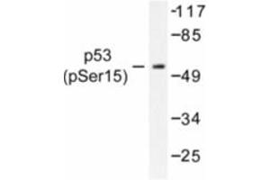 Image no. 1 for anti-Tumor Protein P53 (TP53) (pSer15) antibody (ABIN318091) (p53 抗体  (pSer15))