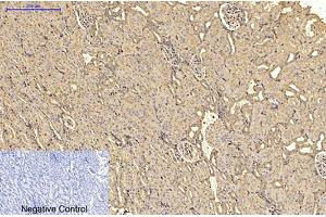 Immunohistochemical analysis of paraffin-embedded rat kidney tissue. (alpha-SMA 抗体)