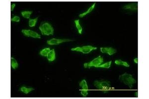 Immunofluorescence (IF) image for anti-Acid Phosphatase 2, Lysosomal (ACP2) antibody (ABIN781949) (ACP2 抗体)
