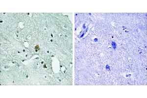 P-peptide - +Immunohistochemistry analysis of paraffin-embedded human brain tissue using IP3R1 (Phospho-Ser1764) antibody. (ITPR1 抗体  (pSer1764))