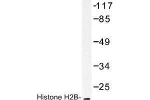 Image no. 1 for anti-Histone H2B antibody (ABIN317616) (Histone H2B 抗体)