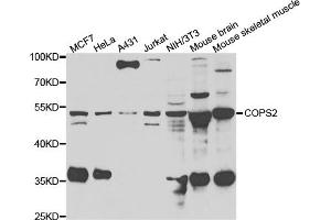 Western blot analysis of extracts of various cell lines, using COPS2 antibody. (COPS2 抗体)