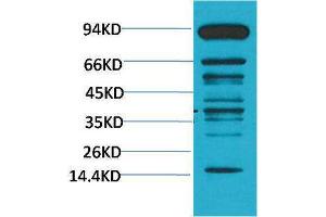 Western Blotting (WB) image for anti-Methylated Lysine (pan) antibody (ABIN3181570) (Methylated Lysine (pan) 抗体)