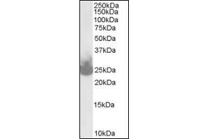 Image no. 1 for anti-Synaptosomal-Associated Protein, 25kDa (SNAP25) (C-Term) antibody (ABIN372760) (SNAP25 抗体  (C-Term))