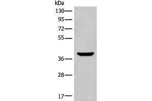 Western blot analysis of Mouse liver tissue lysate using ADORA3 Polyclonal Antibody at dilution of 1:400 (Adenosine A3 Receptor 抗体)