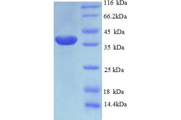 PHF5A Protein (AA 1-110, full length) (GST tag)