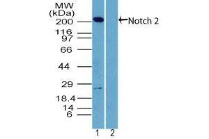 Image no. 1 for anti-Notch 2 (NOTCH2) (AA 1550-1600) antibody (ABIN960288) (NOTCH2 抗体  (AA 1550-1600))