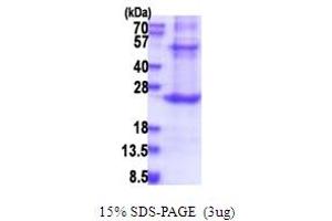 PROCR Protein (AA 18-210) (His tag)