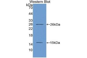 Western Blotting (WB) image for anti-Antigen Identified By Monoclonal Antibody Ki-67 (MKI67) (AA 2815-2928) antibody (ABIN1078250) (Ki-67 抗体  (AA 2815-2928))