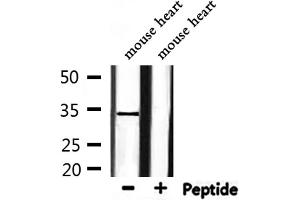 Western blot analysis of extracts from mouse heart, using HP1gamma Antibody. (CBX3 抗体  (Internal Region))
