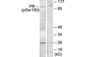 Western Blotting (WB) image for anti-Progesterone Receptor (PGR) (pSer190) antibody (ABIN2888516) (Progesterone Receptor 抗体  (pSer190))