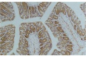 Immunohistochemistry of paraffin-embedded Mouse colon tissue using AMPK alpha1 Monoclonal Antibody at dilution of 1:200. (PRKAA1 抗体)