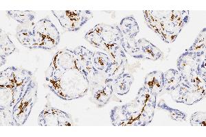 Human placenta: immunohistochemical staining for CD163. (CD163 抗体  (N-Term))