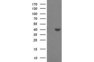 HEK293T cells were transfected with the pCMV6-ENTRY control (Left lane) or pCMV6-ENTRY SULT1C2 (Right lane) cDNA for 48 hrs and lysed. (SULT1C2 抗体)