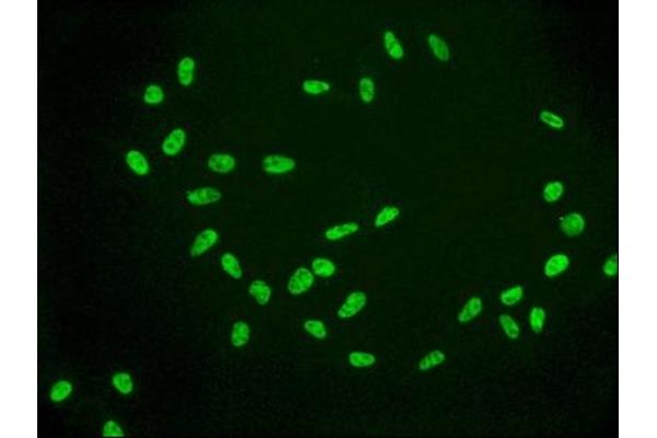 Recombinant HIST1H2AB 抗体  (acLys9)