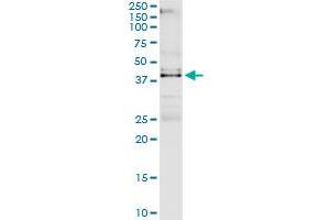 Immunoprecipitation of VRK1 transfected lysate using rabbit polyclonal anti-VRK1 and Protein A Magnetic Bead (VRK1 (人) IP-WB Antibody Pair)