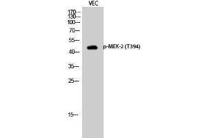 Western Blotting (WB) image for anti-Mitogen-Activated Protein Kinase Kinase 2 (MAP2K2) (pThr394) antibody (ABIN3179468) (MEK2 抗体  (pThr394))