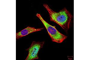 Immunocytochemistry (ICC) image for anti-ATG5 Autophagy Related 5 (ATG5) antibody (ABIN5912316) (ATG5 抗体)