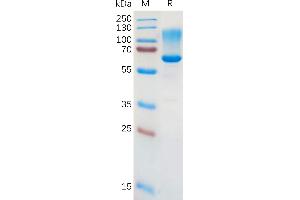 Human CD43 Protein, hFc Tag on SDS-PAGE under reducing condition. (CD43 Protein (AA 20-253) (Fc Tag))