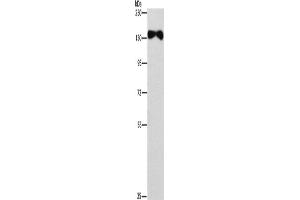Western Blotting (WB) image for anti-Ellis Van Creveld Syndrome 2 (EVC2) antibody (ABIN2433002) (EVC2 抗体)