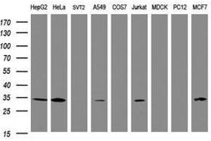 Image no. 5 for anti-Signal Recognition Particle Receptor, B Subunit (SRPRB) antibody (ABIN1501128) (SRPRB 抗体)