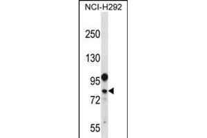 DDX3Y Antibody (N-term) (ABIN656714 and ABIN2845943) western blot analysis in NCI- cell line lysates (35 μg/lane). (DDX3Y 抗体  (N-Term))