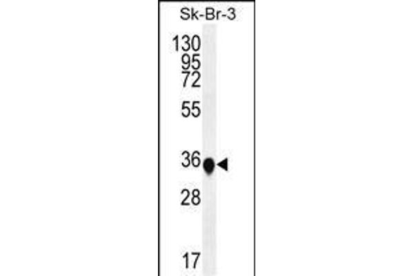 TP53INP1 抗体  (N-Term)