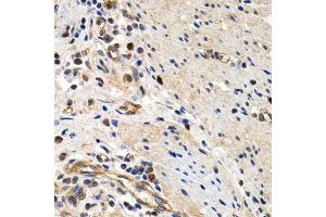 Immunohistochemistry of paraffin-embedded human colon using MCM2 antibody (ABIN5970415) at dilution of 1/200 (40x lens). (MCM2 抗体)