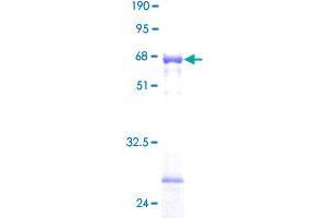 Image no. 1 for Hydroxysteroid (17-Beta) Dehydrogenase 6 (HSD17B6) (AA 1-317) protein (GST tag) (ABIN1307130) (HSD17B6 Protein (AA 1-317) (GST tag))