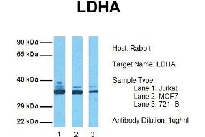 Host: Rabbit Target Name: LDHA Sample Tissue: Human Jurkat, MCF7, 721_B Antibody Dilution: 1. (Lactate Dehydrogenase A 抗体  (Middle Region))